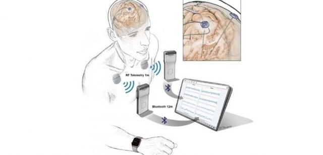 توسعه دستگاه های ردیابی فعالیت مغز
