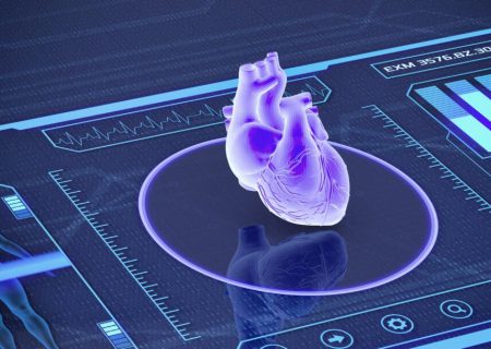 پیش بینی حمله قلبی با عکس رادیولوژی!