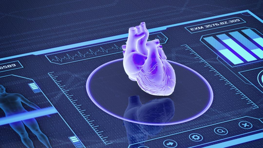 پیش بینی حمله قلبی با عکس رادیولوژی!